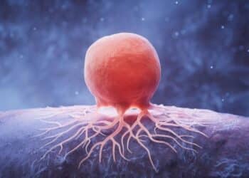 Giảm chất béo có thể ‘bỏ đói’ tế bào ung thư vú